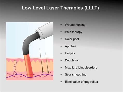 low level laser therapy stirling
